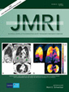 JOURNAL OF MAGNETIC RESONANCE IMAGING雜志封面